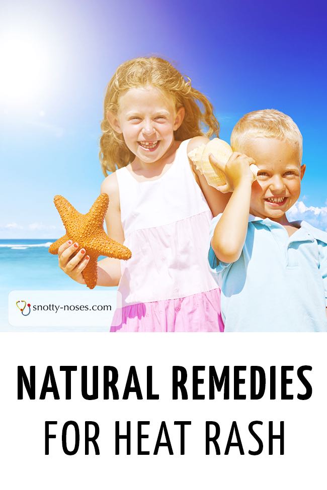 Natural Remedies for Heat Rash in Children