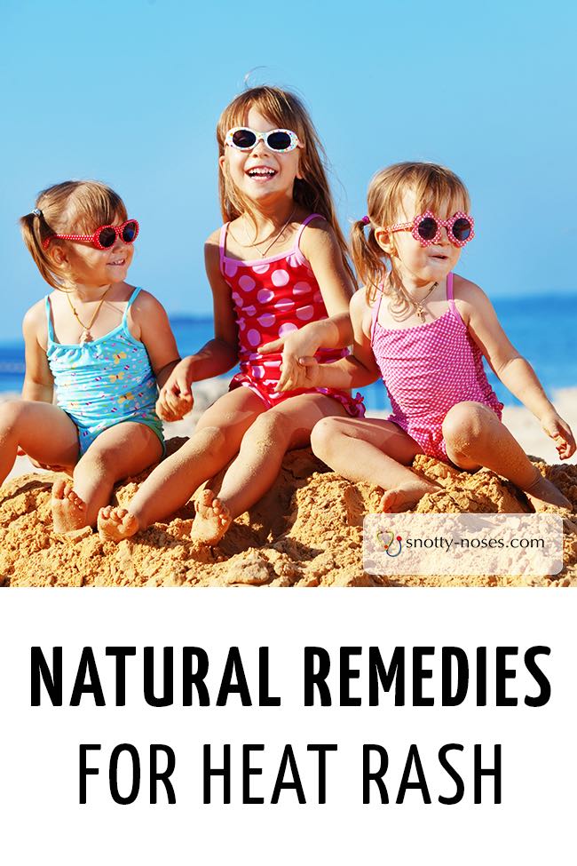 3 girls playing on the beach in summer. None of them He have heat rash.