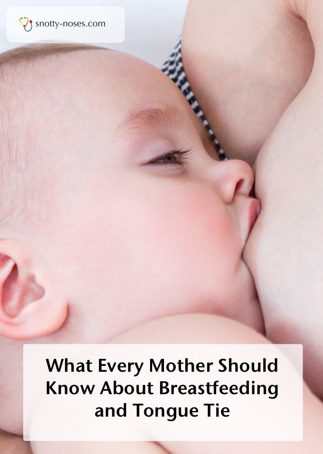 A Tongue Tie Cut can help Breastfeeding