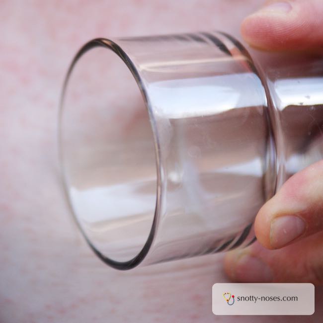 The Glass Test. How to tell if a rash is a non-blanching rash or a blanching rash.