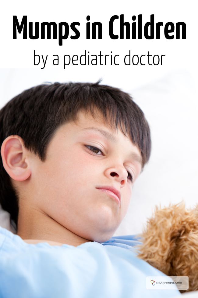 Mumps in Children by a pediatric doctor.