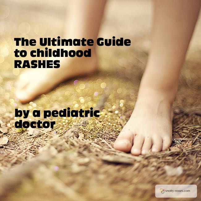 Rashes in Children and Babies by Dr Orlena Kerek pediatrician