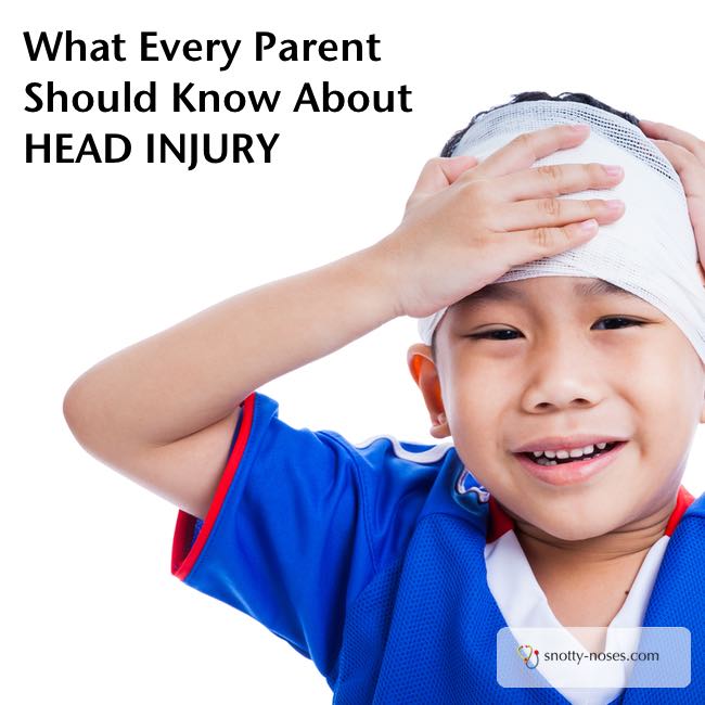 Bump on Head. Head Injury in Children by a pediatrician